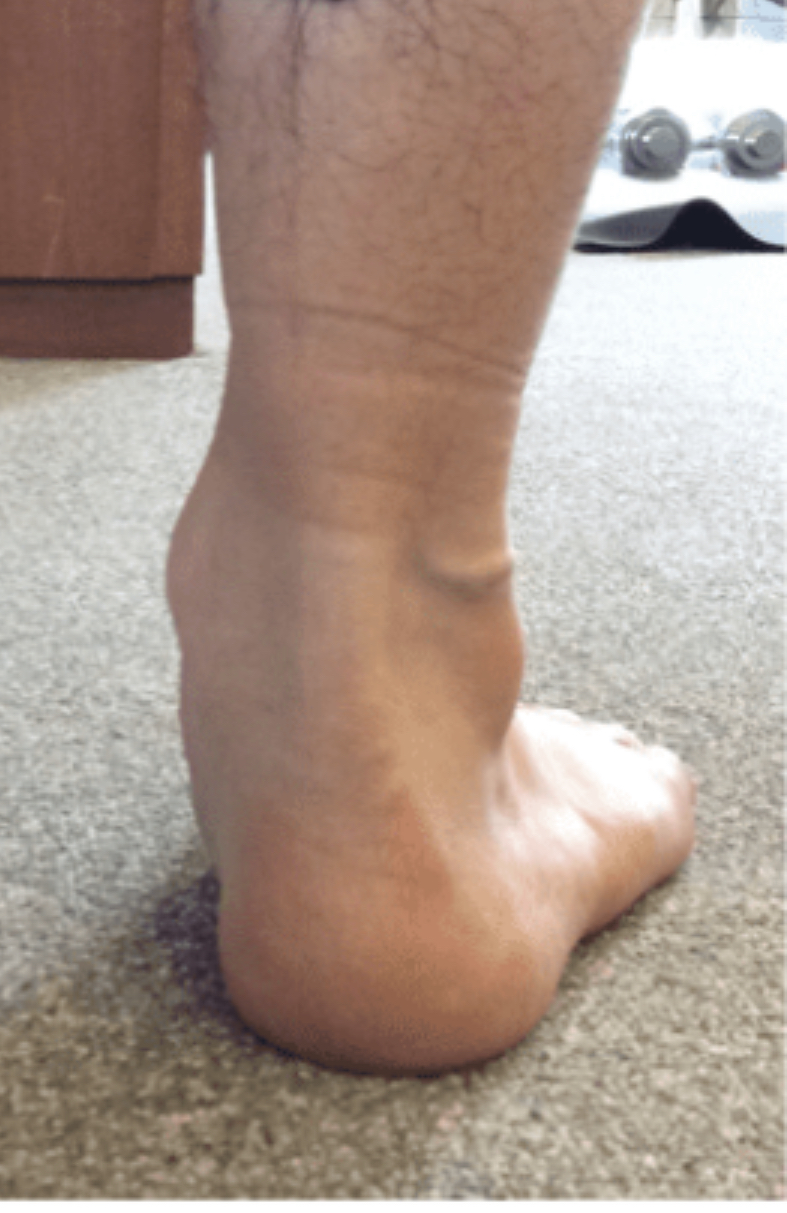 オーダーメイドインソール