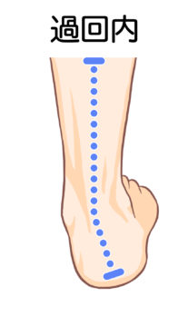 足根洞症候群について