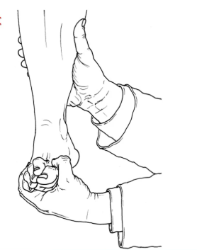 モートン病について